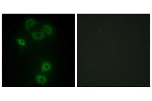 Immunofluorescence analysis of A549 cells, using BMX antibody. (BMX 抗体  (N-Term))
