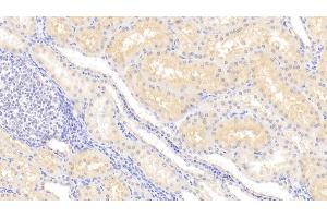 Detection of LCN12 in Human Kidney Tissue using Polyclonal Antibody to Lipocalin 12 (LCN12) (LCN12 抗体  (AA 61-184))