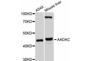Western blot analysis of extracts of various cell lines, using AADAC antibody. (AADAC 抗体)