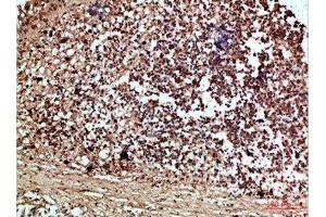 Immunohistochemical analysis of paraffin-embedded human-thyroid, antibody was diluted at 1:200 (RCC1 抗体  (AA 301-350))