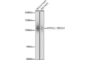 Western Blotting (WB) image for anti-ATPase, Ca++ Transporting, Cardiac Muscle, Slow Twitch 2 (ATP2A2) (AA 111-253) antibody (ABIN3021430)