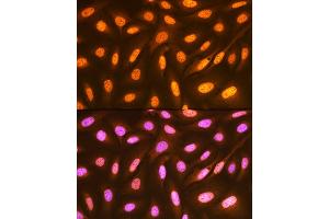 Immunofluorescence analysis of U-2 OS cells using FUBP1 Rabbit mAb (ABIN7267128) at dilution of 1:100 (40x lens). (FUBP1 抗体)