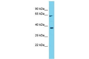 Host: Rabbit  Target Name: Cyp1b1  Sample Tissue: Rat Testis lysates  Antibody Dilution: 1. (CYP1B1 抗体  (C-Term))