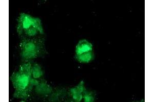 Anti-TBCC mouse monoclonal antibody (ABIN2455797) immunofluorescent staining of COS7 cells transiently transfected by pCMV6-ENTRY TBCC (RC203563). (TBCC 抗体)