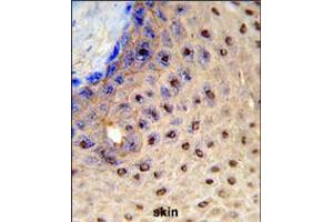 Formalin-fixed and paraffin-embedded human skin reacted with PAX3 Antibody (N-term), which was peroxidase-conjugated to the secondary antibody, followed by DAB staining. (Paired Box 3 抗体  (N-Term))