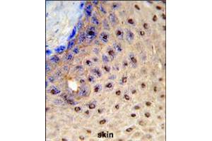 Formalin-fixed and paraffin-embedded human skin reacted with PAX3 Antibody (N-term), which was peroxidase-conjugated to the secondary antibody, followed by DAB staining.