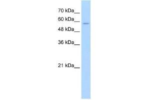 Western Blotting (WB) image for anti-Solute Carrier Family 22 (Organic Cation Transporter), Member 16 (SLC22A16) (N-Term) antibody (ABIN2781701)