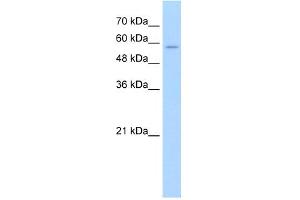 WB Suggested Anti-SLC22A16 Antibody Titration:  2. (SLC22A16 抗体  (N-Term))
