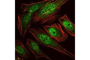 Immunofluorescence analysis of Hela cells using RUNX1 mouse mAb (green). (RUNX1 抗体)