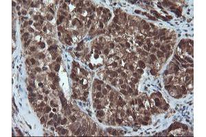 Image no. 1 for anti-Proteasome Subunit alpha 6 (PSMA6) antibody (ABIN1500465) (PSMA6 抗体)