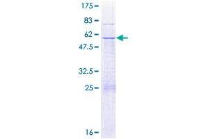 PACRG Protein (AA 1-257) (GST tag)