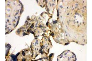 IHC testing of frozen human placenta with YB1 antibody. (YBX1 抗体)