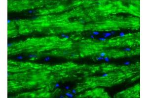 Image no. 1 for anti-Cardiotin antibody (ABIN959509) (Cardiotin 抗体)