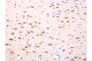IHC-P Image Islet 1 antibody detects Islet 1 protein at nucleus on rat fore brain by immunohistochemical analysis. (ISL1 抗体)