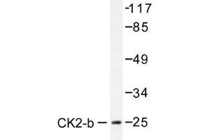 Image no. 1 for anti-Casein Kinase 2, beta (CSNK2B) antibody (ABIN272014) (CSNK2B 抗体)