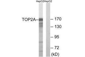 Western blot analysis of extracts from HepG2 cells, using TOP2A (Ab-1343) antibody.