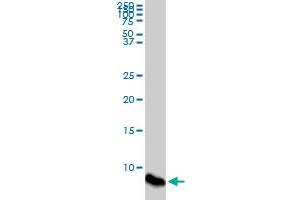 ATOX1 monoclonal antibody (M08), clone 4D6. (ATOX1 抗体  (AA 1-68))