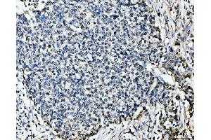 IHC analysis of MCM6 using anti-MCM6 antibody (ABIN7600038). (MCM6 抗体  (AA 14-821))