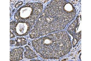 IHC analysis of Aconitase 2 using anti-Aconitase 2 antibody (ABIN7602770). (ACO2 抗体  (C-Term))