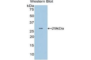 Western Blotting (WB) image for anti-CD36 (CD36) (AA 91-311) antibody (ABIN1859048) (CD36 抗体  (AA 91-311))