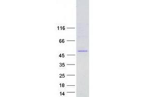 Western Blotting (WB) image for Ferrochelatase (FECH) (Transcript Variant 1) protein (Myc-DYKDDDDK Tag) (ABIN2721023)