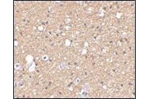Immunohistochemical staining of human brain tissue using AP30785PU-N SIRT2 antibody at 2. (SIRT2 抗体  (C-Term))