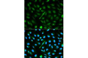 Immunofluorescence analysis of MCF-7 cells using AHSG antibody. (Fetuin A 抗体)