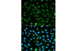 Immunofluorescence analysis of MCF-7 cells using AHSG antibody. (Fetuin A 抗体)