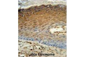 Immunohistochemistry (IHC) image for anti-Adenylate Kinase 7 (AK7) antibody (ABIN3002976) (Adenylate Kinase 7 抗体)
