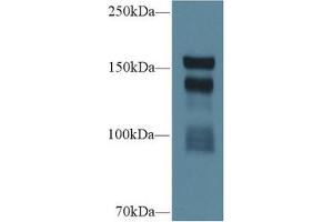 Western blot analysis of Rat Serum, using Rat THBS1 Antibody (1 µg/ml) and HRP-conjugated Goat Anti-Rabbit antibody ( (Thrombospondin 1 抗体  (AA 511-670))