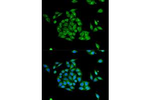 Immunofluorescence analysis of HeLa cell using PICK1 antibody. (PICK1 抗体  (AA 260-360))