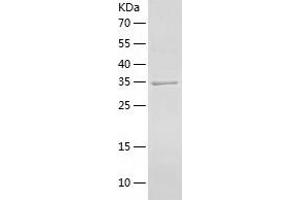 Western Blotting (WB) image for ADP-Ribosylation Factor Interacting Protein 2 (ARFIP2) (AA 1-341) protein (His tag) (ABIN7121738) (ARFIP2 Protein (AA 1-341) (His tag))