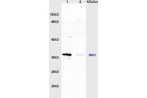 Lane 1: mouse liver lysates Lane 2: mouse intestine lysates probed with Anti HSD17B1/HSD17 Polyclonal Antibody, Unconjugated  at 1:200 in 4˚C. (HSD17B1 抗体  (AA 21-120))