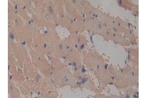 Detection of ICAM2 in Rat Heart Tissue using Polyclonal Antibody to Intercellular Adhesion Molecule 2 (ICAM2)