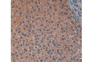 Used in DAB staining on fromalin fixed paraffin-embedded Liver tissue (LAP 抗体  (AA 320-519))