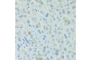 Immunohistochemistry of paraffin-embedded mouse liver using PDC antibody (ABIN6293719) at dilution of 1:100 (40x lens). (Phosducin 抗体)