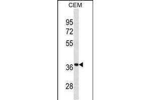 TT Antibody (Center) (ABIN1881957 and ABIN2838927) western blot analysis in CEM cell line lysates (35 μg/lane). (TTPA 抗体  (AA 82-108))
