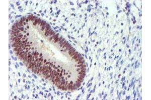 Immunohistochemical staining of paraffin-embedded Human endometrium tissue using anti-PDSS2 mouse monoclonal antibody. (PDSS2 抗体)