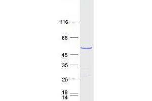 Western Blotting (WB) image for Heterogeneous Nuclear Ribonucleoprotein H1 (H) (HNRNPH1) protein (Myc-DYKDDDDK Tag) (ABIN2722922)