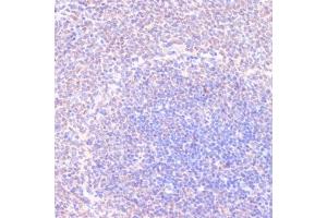 Immunohistochemistry of paraffin-embedded rat spleen using RXRG antibody (ABIN6128667, ABIN6147330, ABIN6147331 and ABIN6219010) at dilution of 1:100 (40x lens). (Retinoid X Receptor gamma 抗体  (AA 1-137))