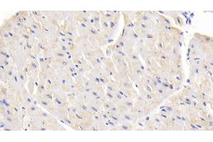 Detection of LEP in Bovine Cardiac Muscle Tissue using Polyclonal Antibody to Leptin (LEP) (Leptin 抗体  (AA 29-160))