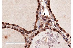 ABIN184783 (4µg/ml) staining of paraffin embedded Human Thyroid Gland. (PAX8 抗体  (N-Term))