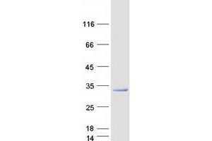 Western Blotting (WB) image for RAB3C, Member RAS Oncogene Family (Rab3c) protein (Myc-DYKDDDDK Tag) (ABIN2730349)