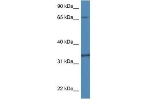 Western Blot showing Tbcb antibody used at a concentration of 1. (TBCB 抗体  (N-Term))