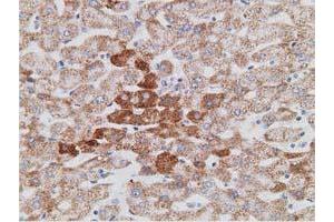 Immunohistochemical staining of paraffin-embedded Human liver tissue using anti-PECR mouse monoclonal antibody. (PECR 抗体)