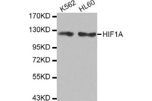 Western Blotting (WB) image for anti-Hypoxia Inducible Factor 1, alpha Subunit (Basic Helix-Loop-Helix Transcription Factor) (HIF1A) antibody (ABIN1980281) (HIF1A 抗体)