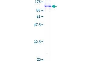 NDUFS1 Protein (AA 1-727) (GST tag)