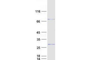 Validation with Western Blot