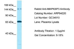 Western Blotting (WB) image for anti-Mitogen-Activated Protein Kinase 8 Interacting Protein 3 (MAPK8IP3) (N-Term) antibody (ABIN2789770) (JIP3 抗体  (N-Term))