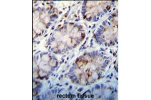 C1QC Antibody immunohistochemistry analysis in formalin fixed and paraffin embedded human rectum tissue followed by peroxidase conjugation of the secondary antibody and DAB staining. (C1QC 抗体  (AA 93-120))